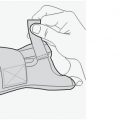 neoprene-thumb-wrist-splint-with-hard-bar-steps-1