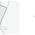 terrycloth-shin-support-steps-3