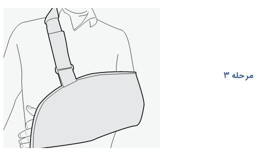 arm-sling--soft--orthopedic--sling-steps-3