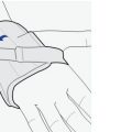 night-wrist-support-with-splint-steps-4