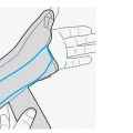 wrist-thumb-splint-with-hard-bar-1-2