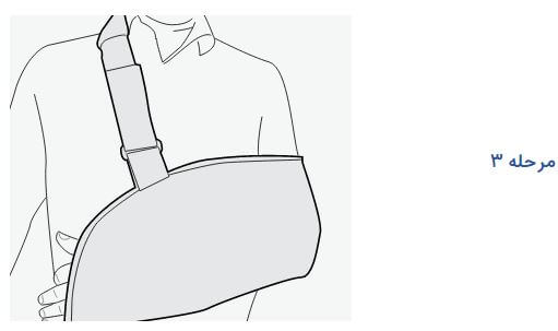 arm-sling-with-shoulder-control-3