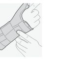 wrist-thumb-splint-with-hard-bar-1-4