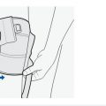 adjustable-knee-support-closed-patella-4