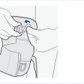 adjustable-knee-support-closed-patella-7